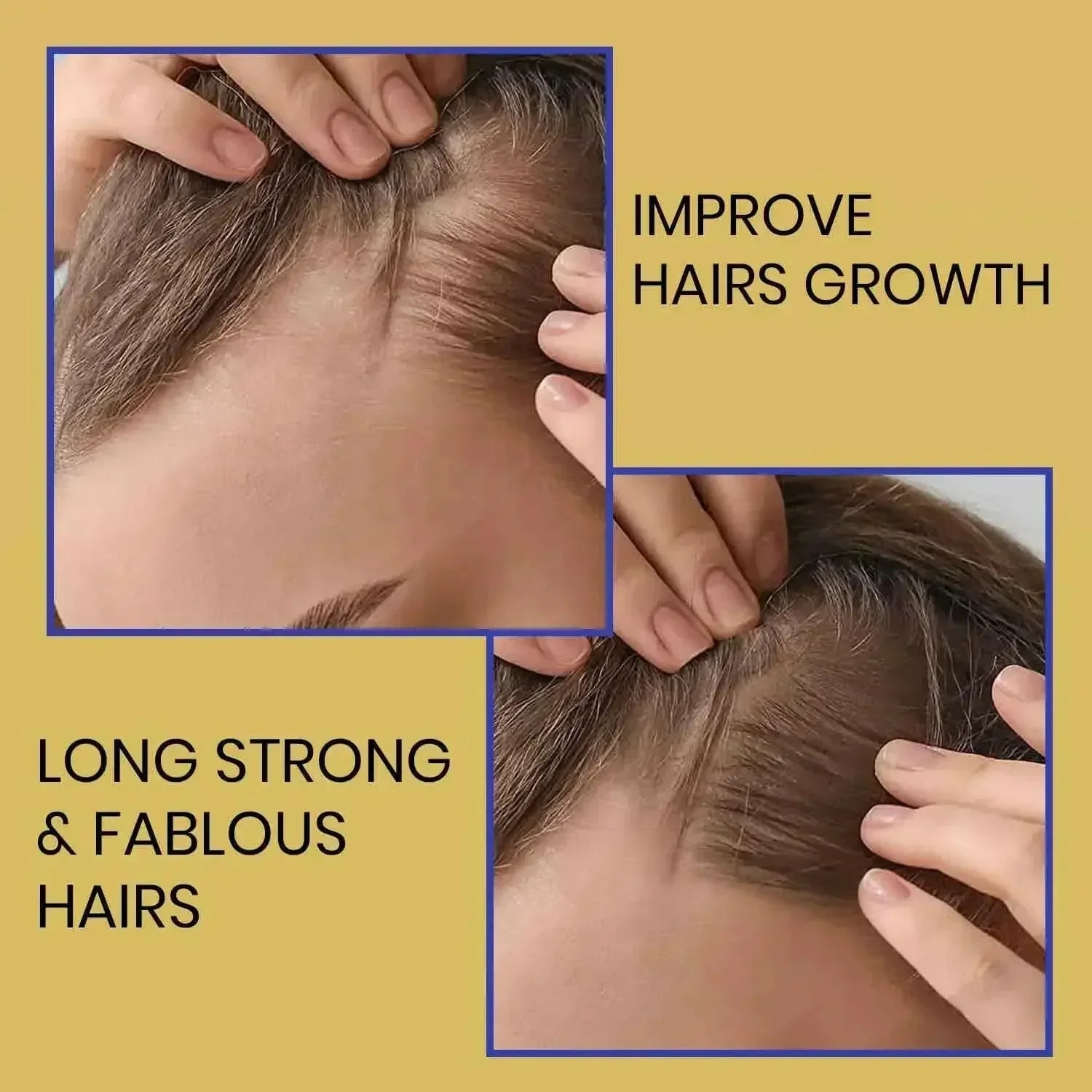 Biotin Haircare Set – Anti-Hair Loss Shampoo & Strengthening Serum for Men & Women | Ammuri