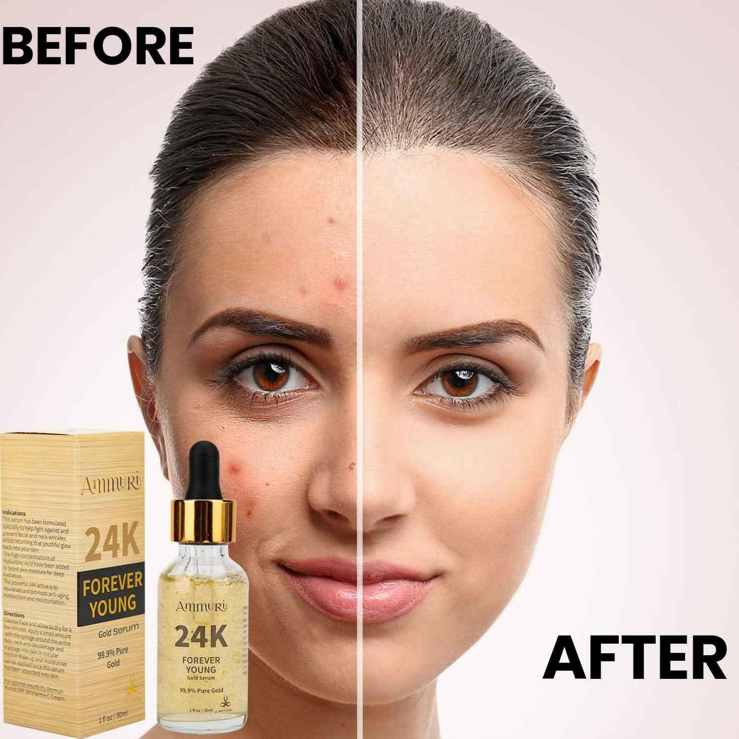 24K Gold Face Serum for Radiance & Anti-Ageing | Ammuri