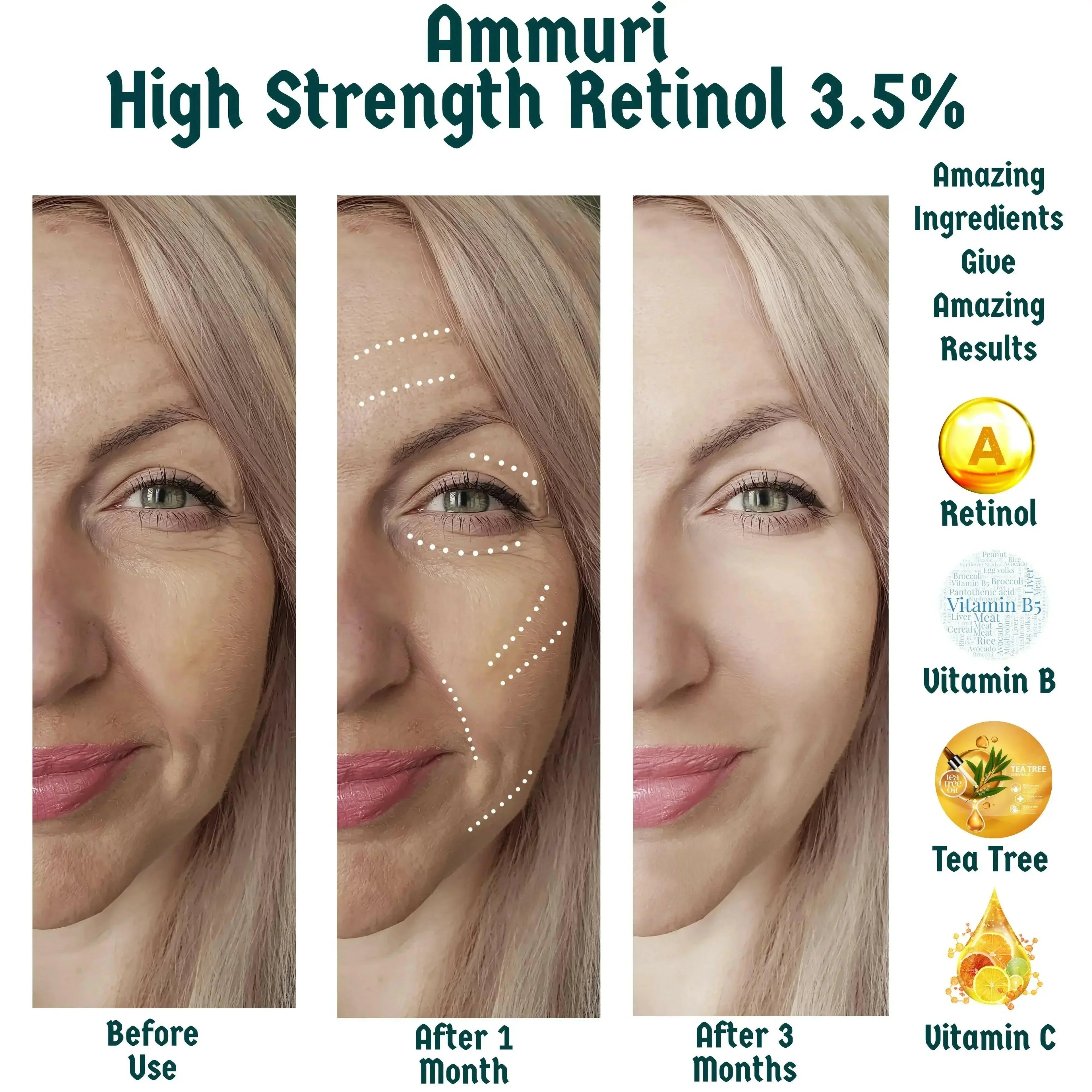 Retinol 3.5% Face Serum for Anti-Ageing & Skin Renewal | Ammuri
