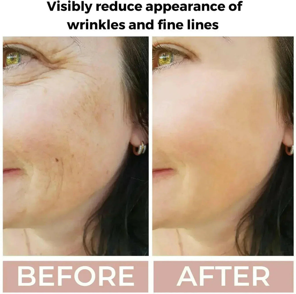 Retinol 3.5% Face Serum for Anti-Ageing & Skin Renewal | Ammuri
