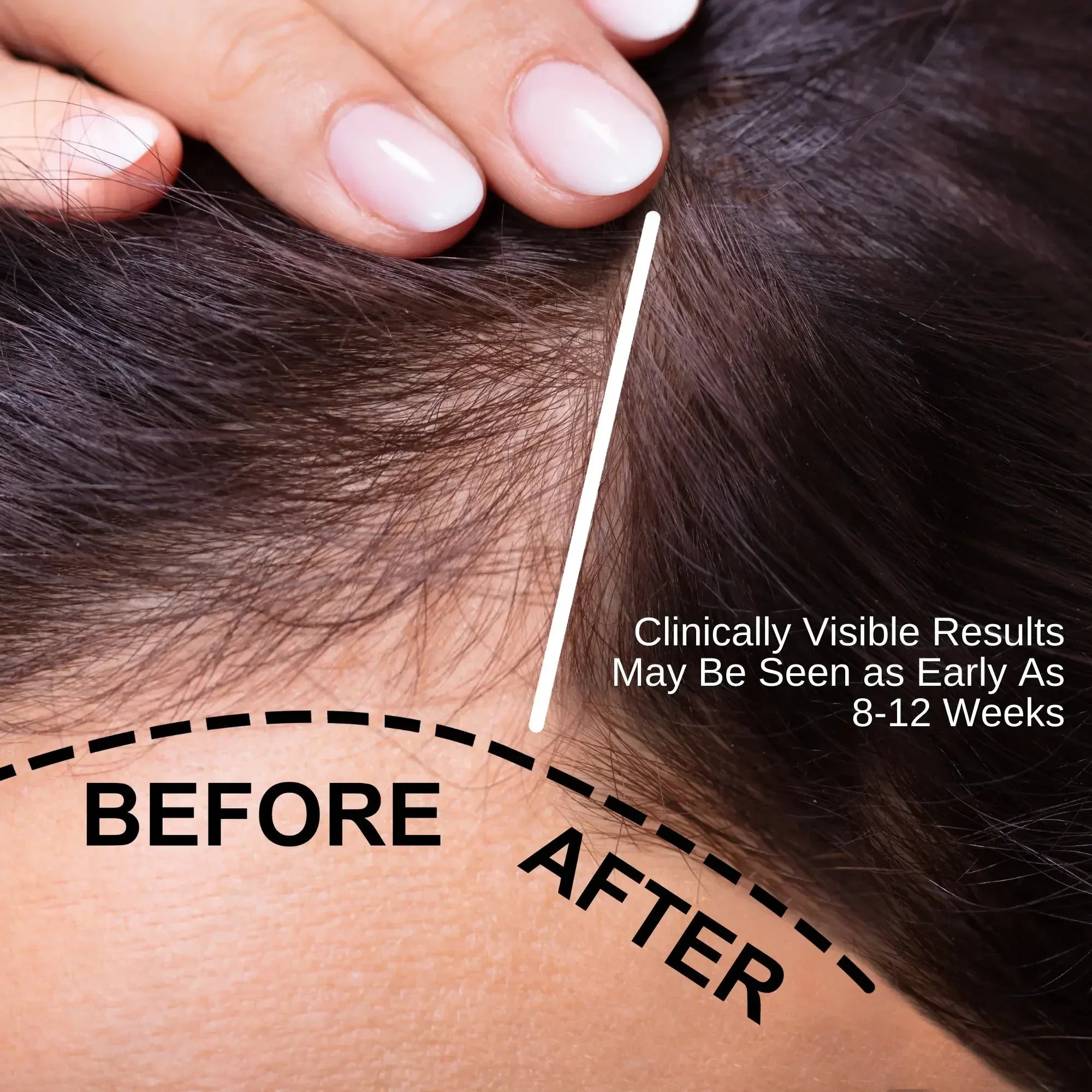 Natural Hair Oil for Hair Thinning & Scalp Nourishment (50ml) | Ammuri
