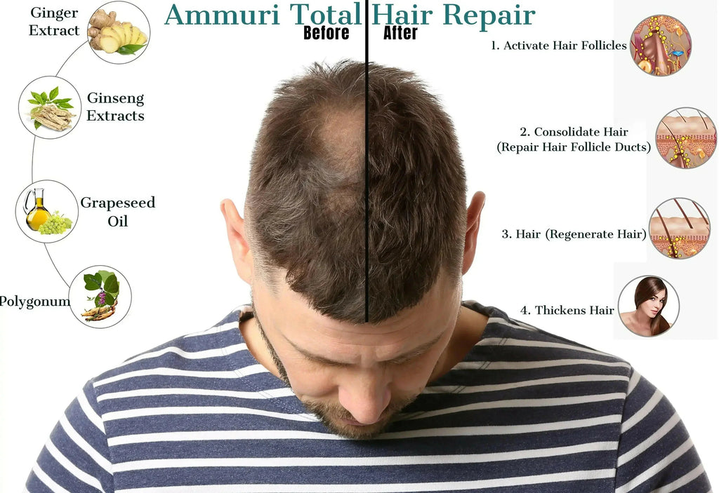 Natural Hair Oil for Hair Thinning & Scalp Nourishment (50ml) | Ammuri