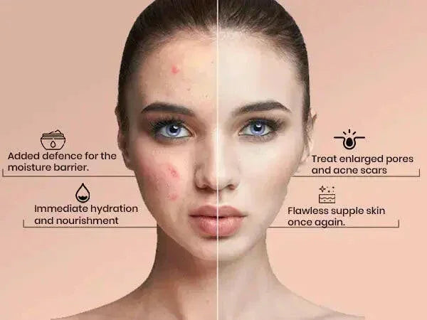 Q10 Face Cream & Retinol 2.5% Firming Day & Night Cream | Ammuri