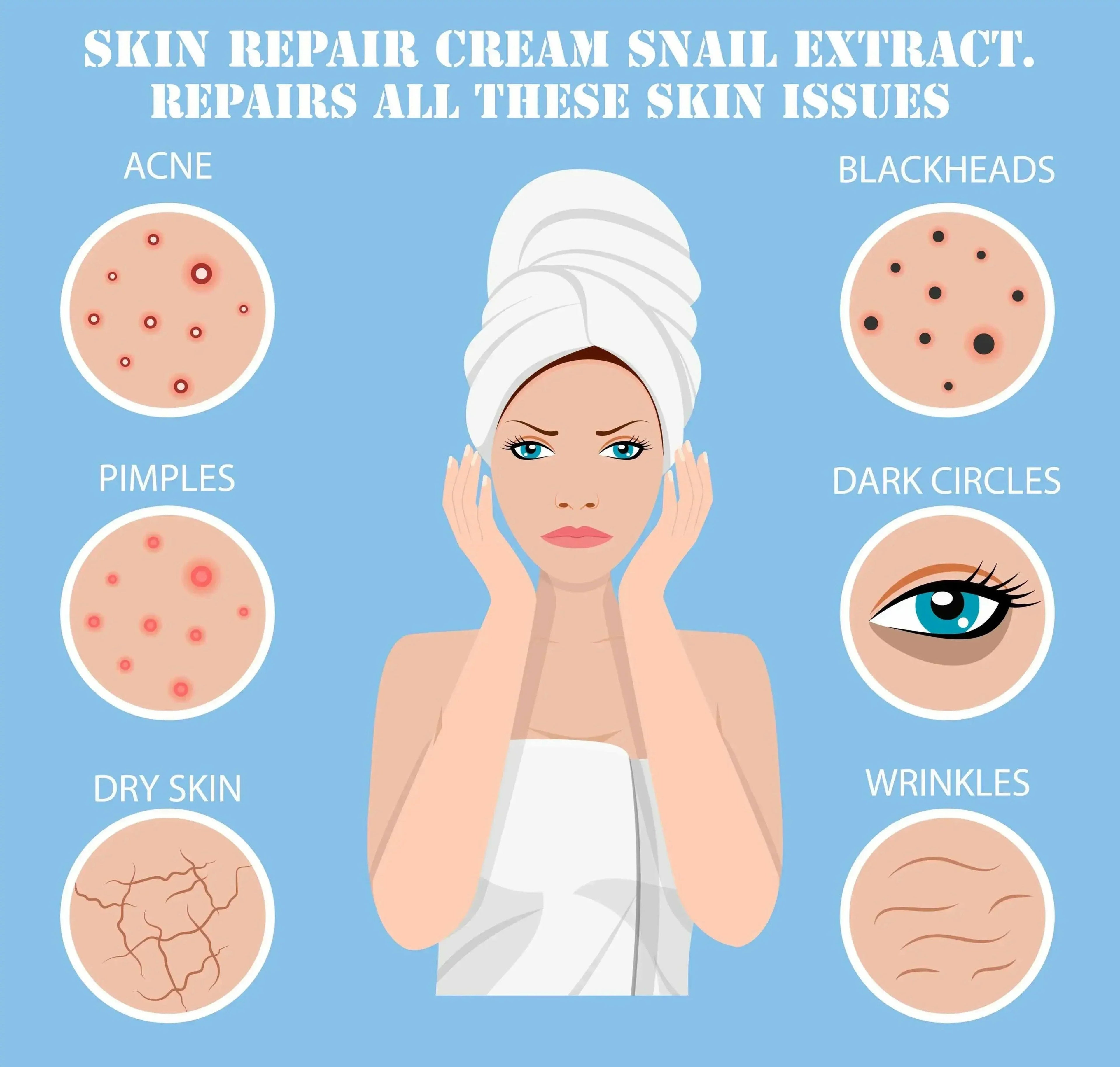Snail Extract Skin Cream for Deep Repair & Hydration | Ammuri
