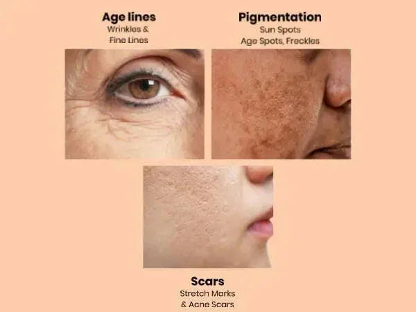 Apple Stem Cell Age Reverse Cream for Wrinkles & Skin Renewal | Ammuri