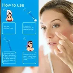 Microneedling Serum Roller for Anti-Ageing & Youthful Skin | Ammuri